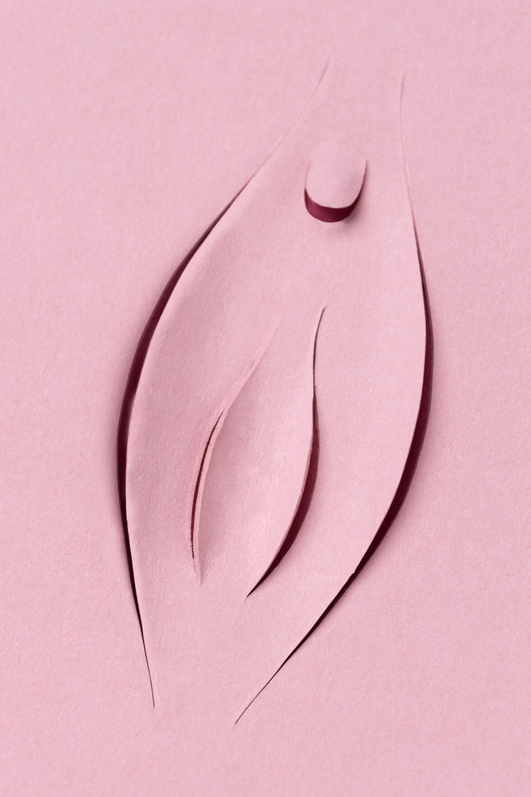 Labioplastia - Dra. Luz María Cañavera