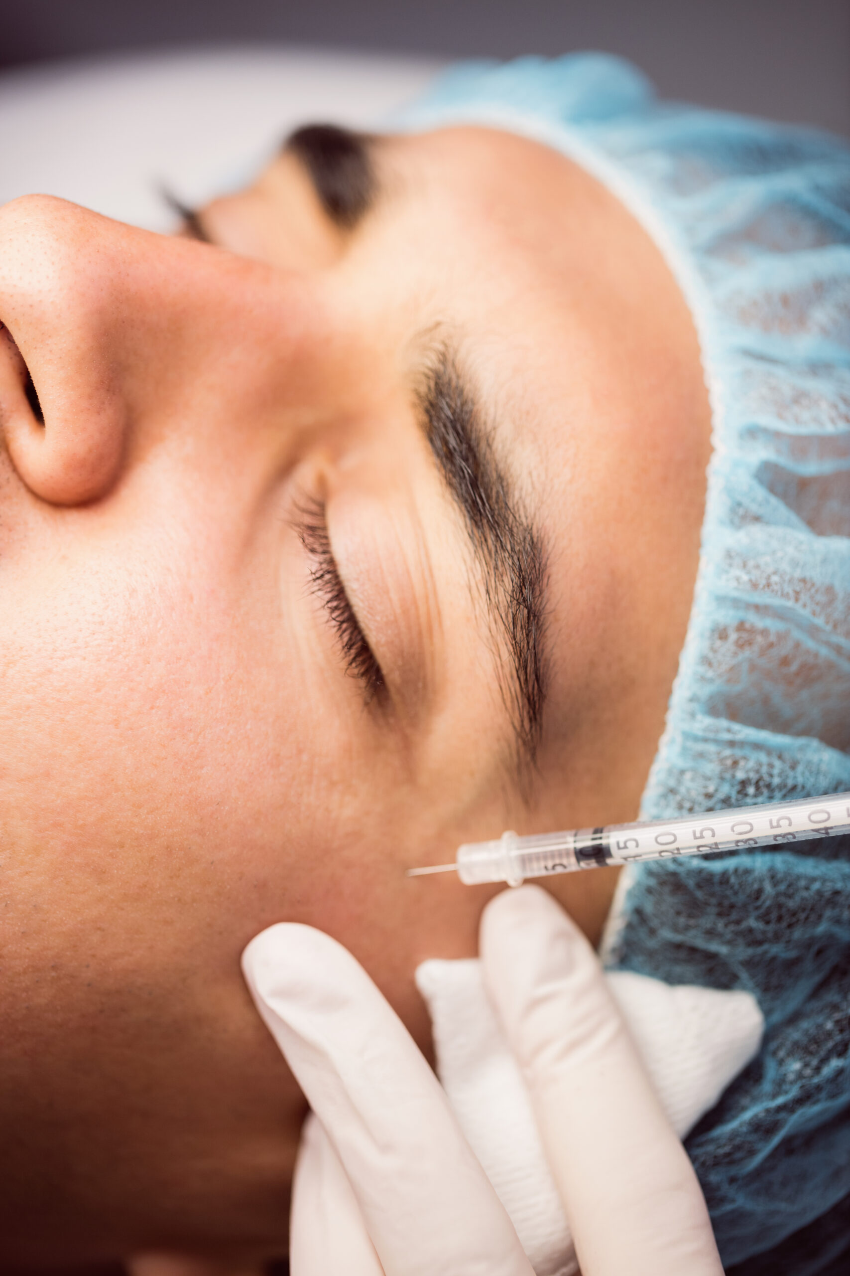 Tratamiento de Botox